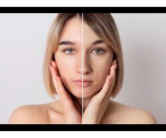 Bio Light Clinic