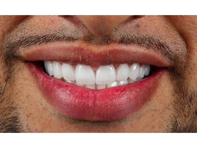 Al Fawzy Dental