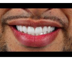 Al Fawzy Dental