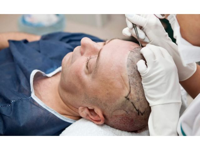 Lova Hair Skin Clinic